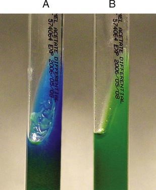 醋酸盐利用试验 E.coli